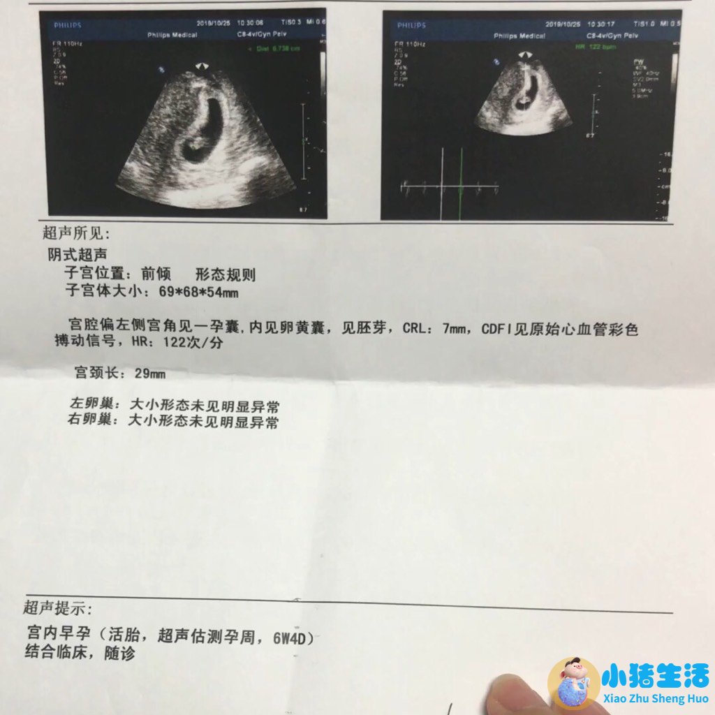 怀孕22周胖多少斤正常