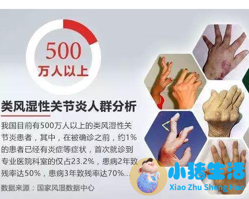 风湿病是怎么形成的（什么是风湿）