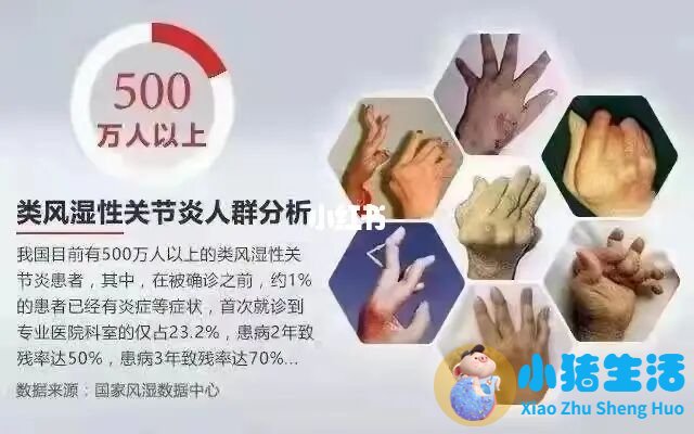 风湿可以用火烤好吗