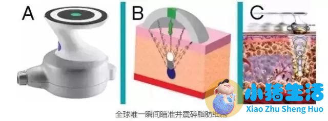 康熙来了 局部减肥