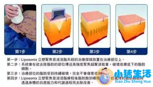 康熙来了 局部减肥