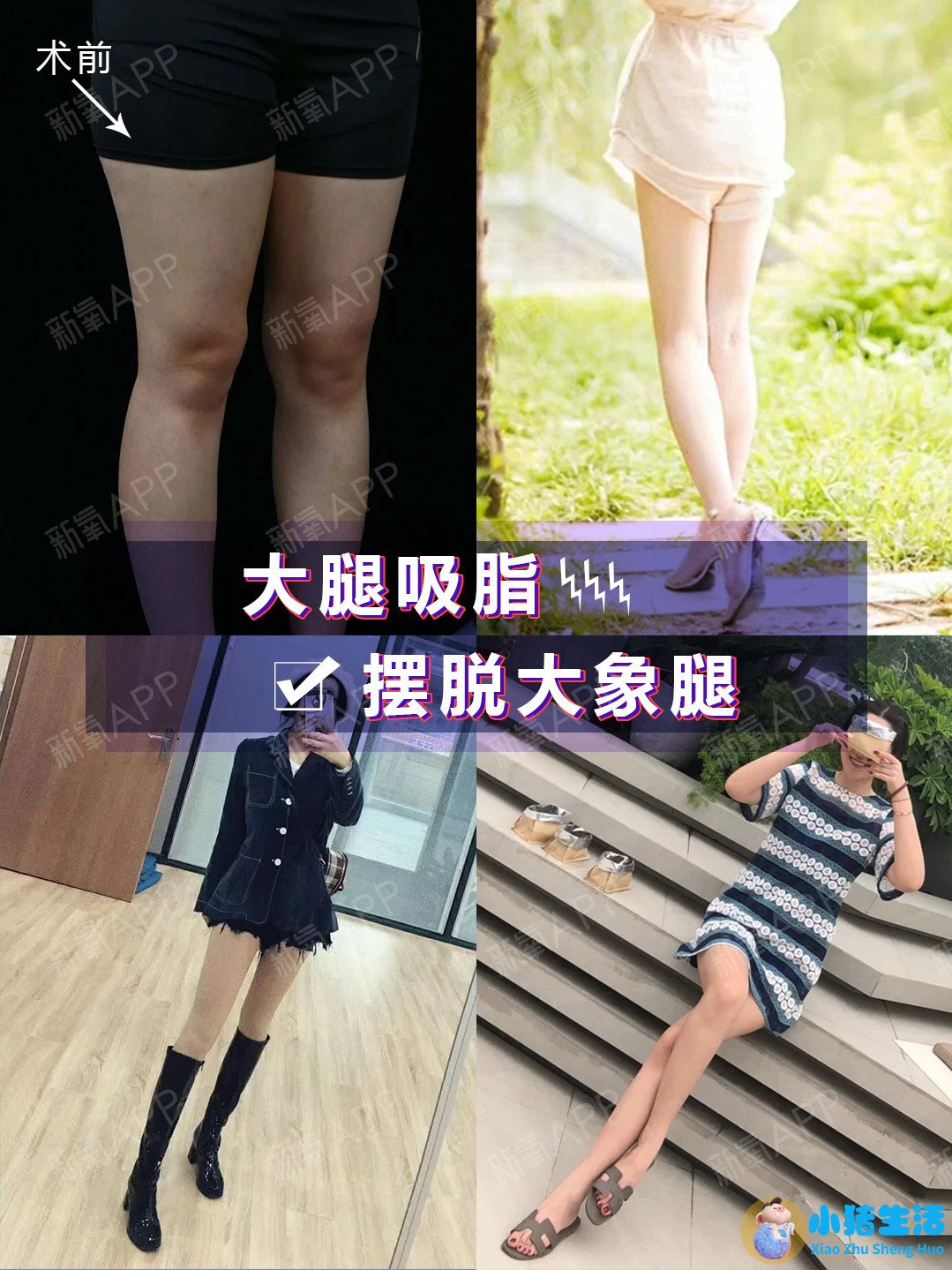 康熙来了 局部减肥