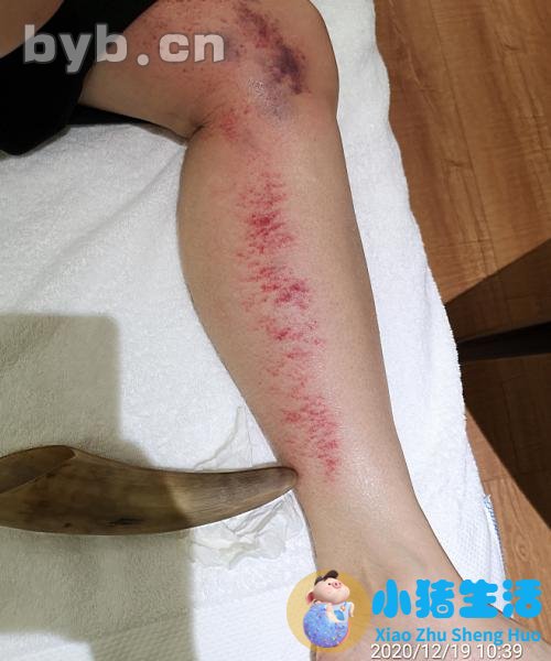 康熙来了 局部减肥