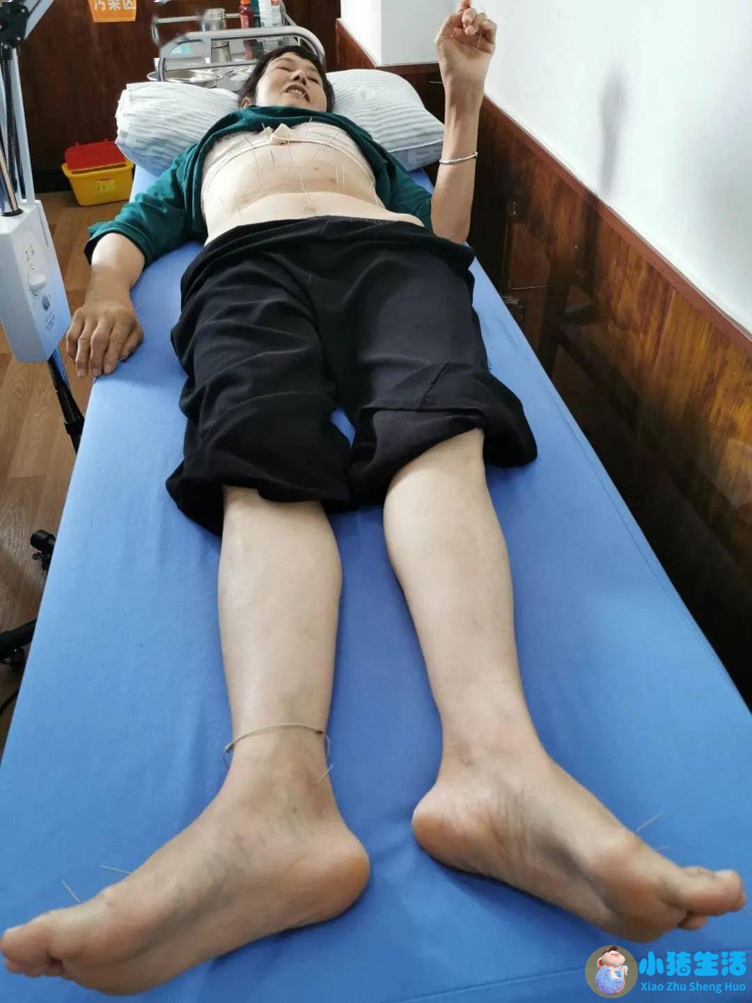 风湿可以用火烤好吗