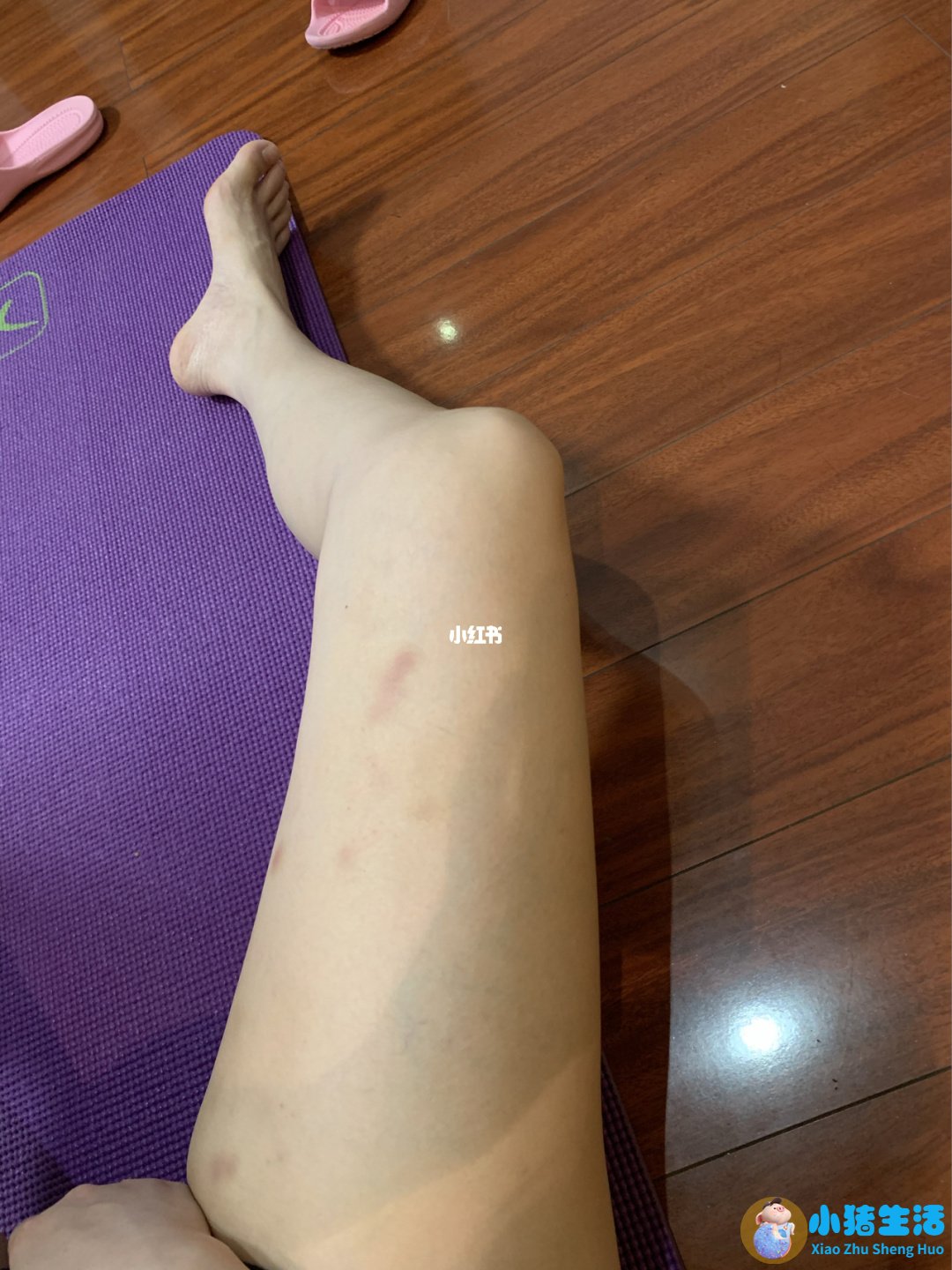 <strong>刮痧瘦腿 最不反弹的瘦腿方式介绍</strong>