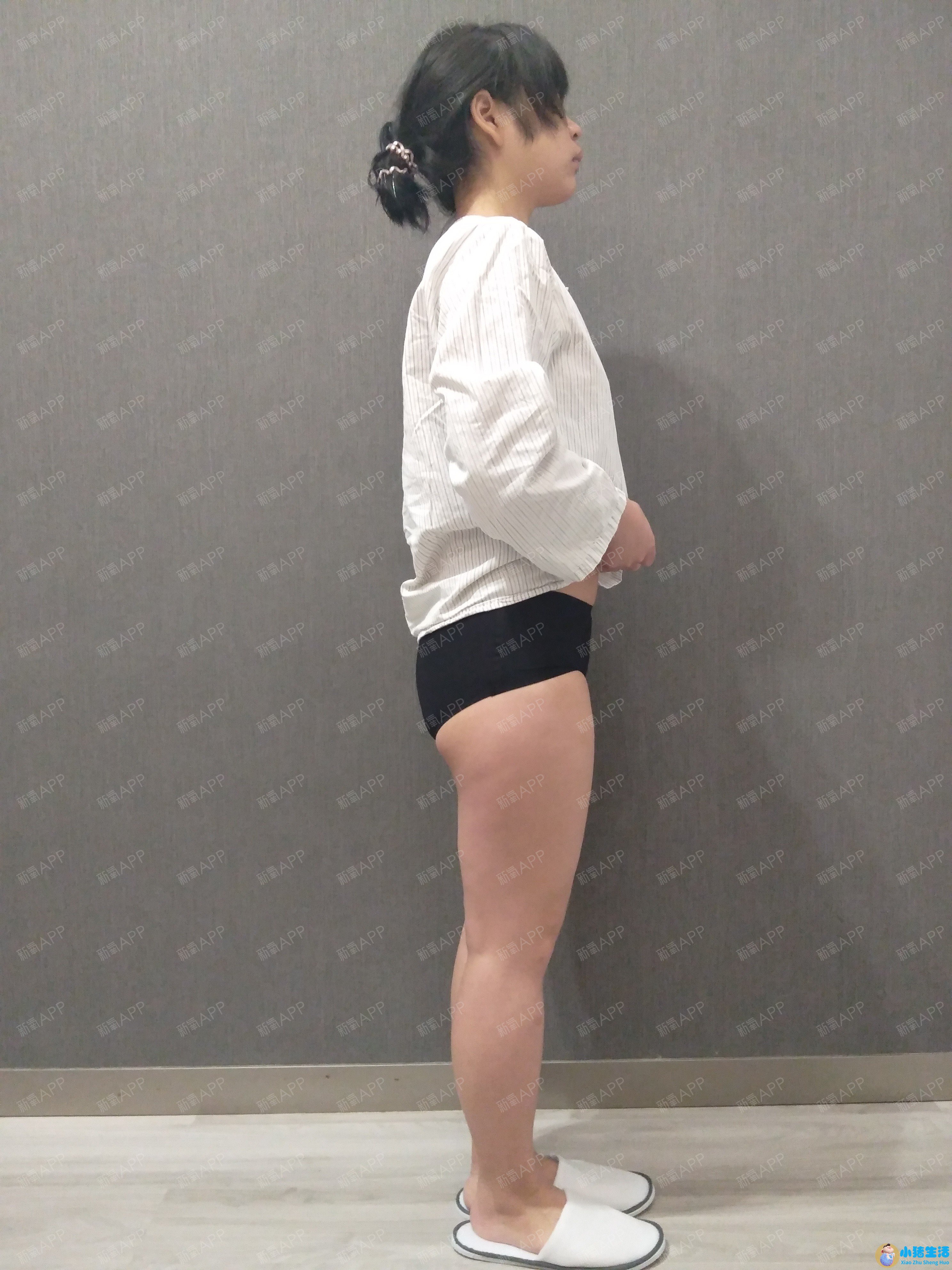 「局部减脂」真的能只瘦局部吗？
