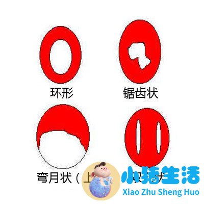 小女孩外生殖器发育异常怎么办