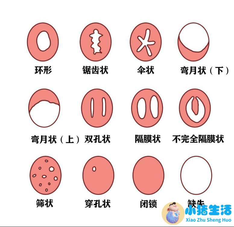 小女孩外生殖器发育异常怎么办
