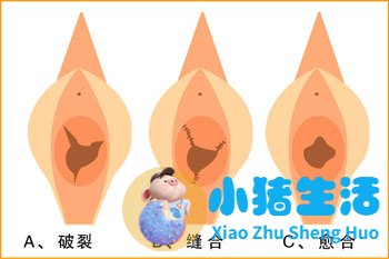 小女孩外生殖器发育异常怎么办