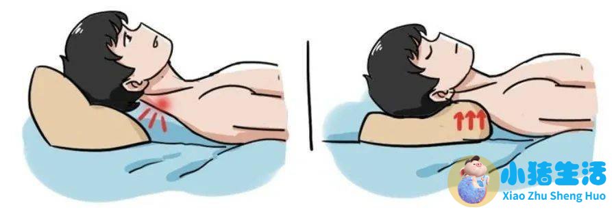 哺乳期怎样去头皮屑