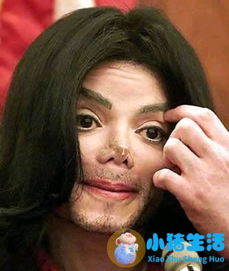 鼻子整形整容失败案例