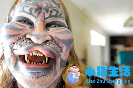 鼻子整形整容失败案例