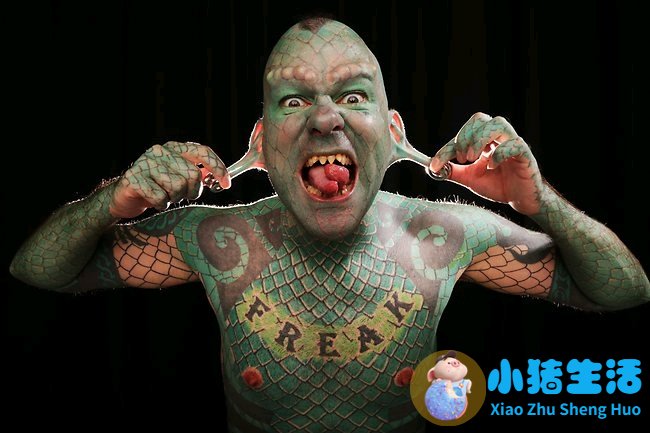 鼻子整形整容失败案例