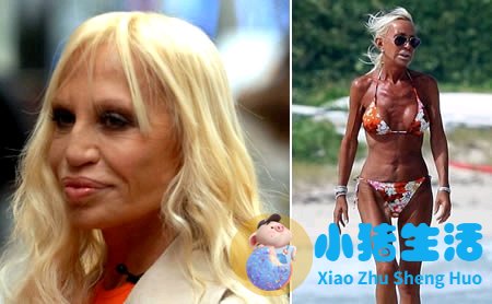 鼻子整形整容失败案例