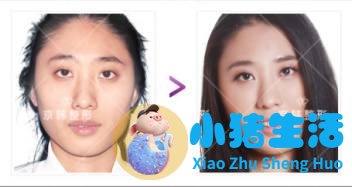 乔爱军整形案例 乔女郎晶晶背后的故事：