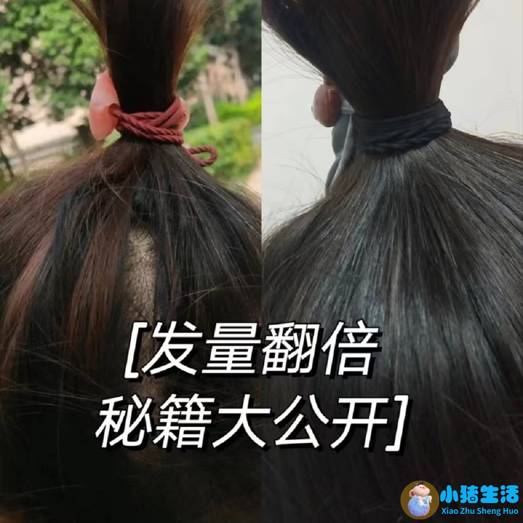 过来人的育发妙招，坚持使用，让你轻松