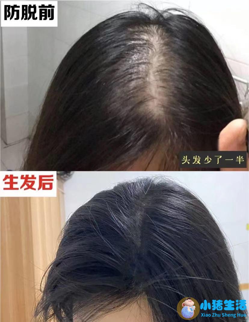 吃什么食物可以长头发