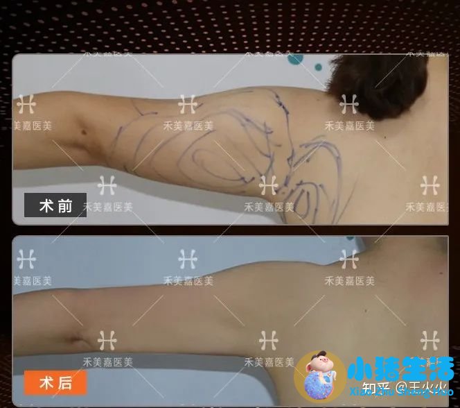 乔爱军整形案例