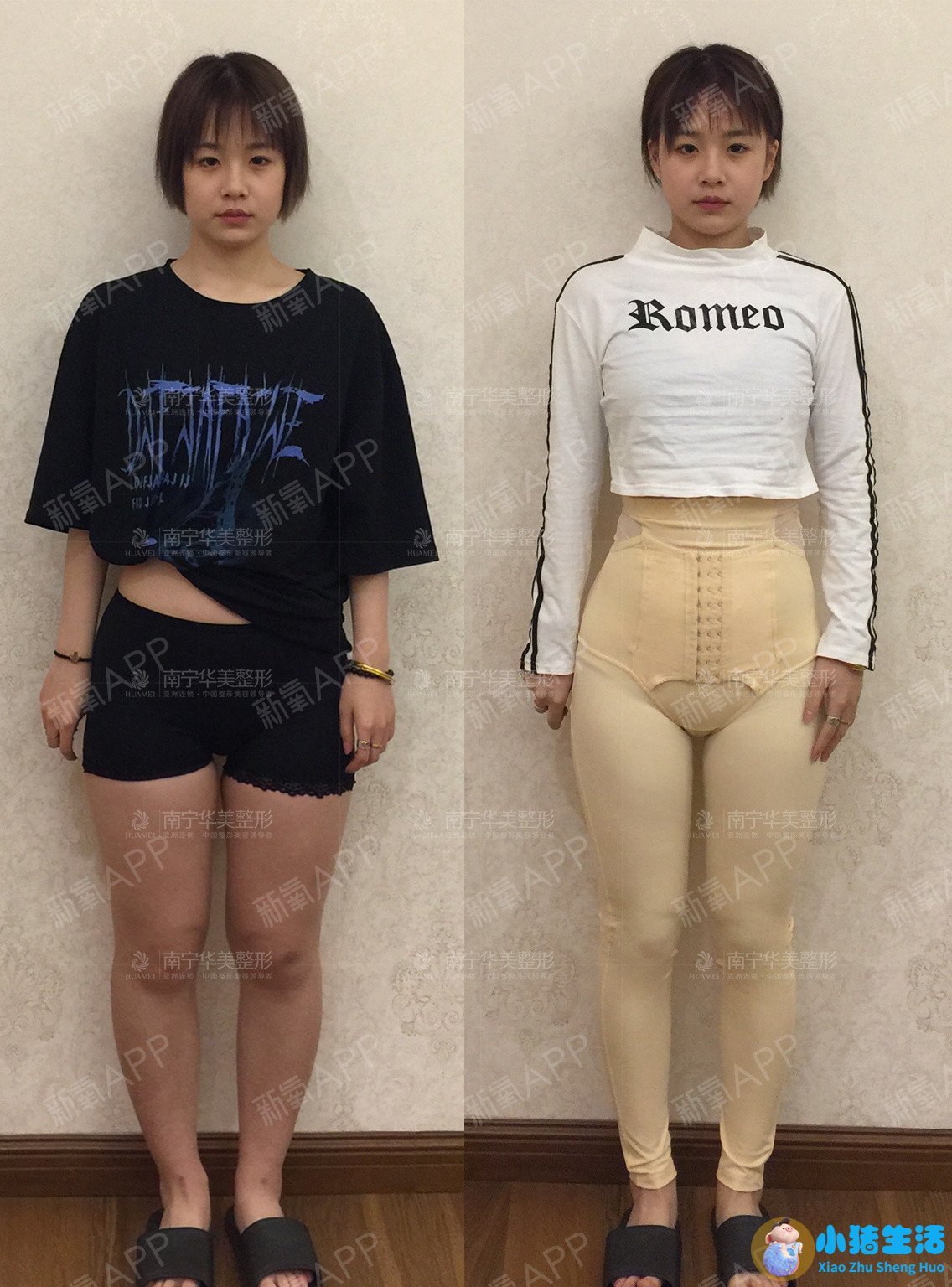 乔爱军整形案例