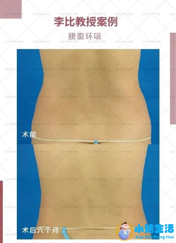 乔爱军整形案例