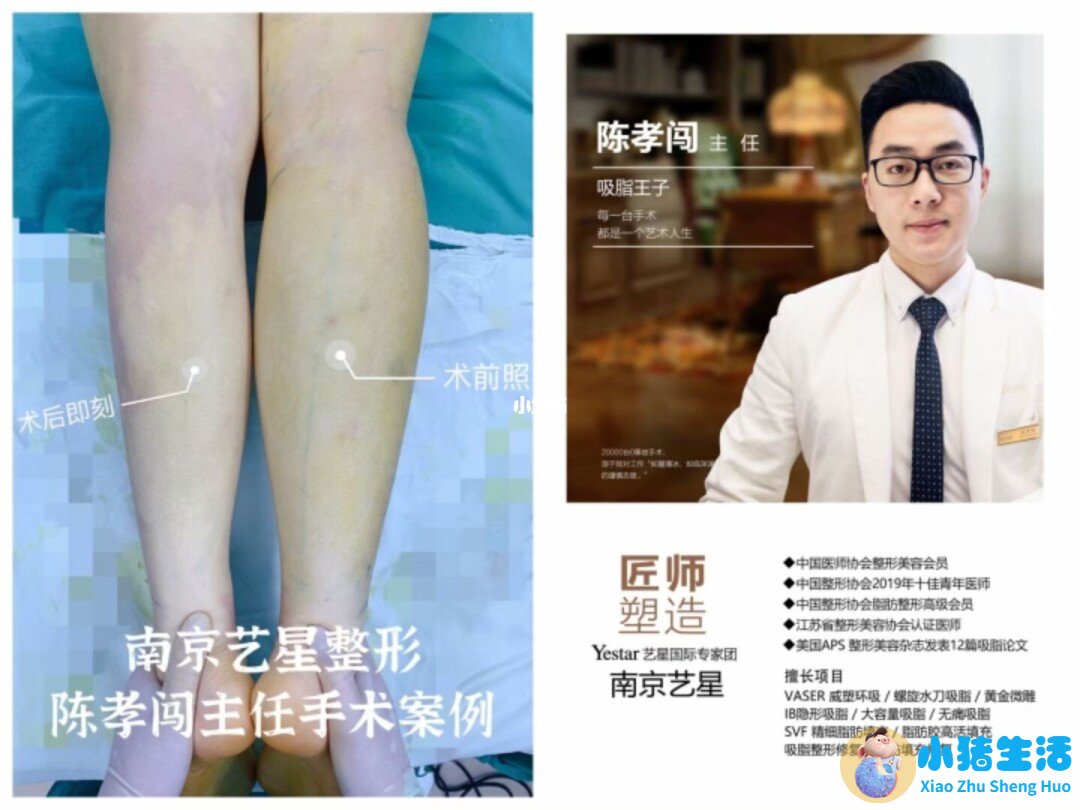 乔爱军整形案例