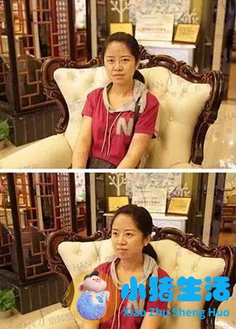 乔爱军整形案例