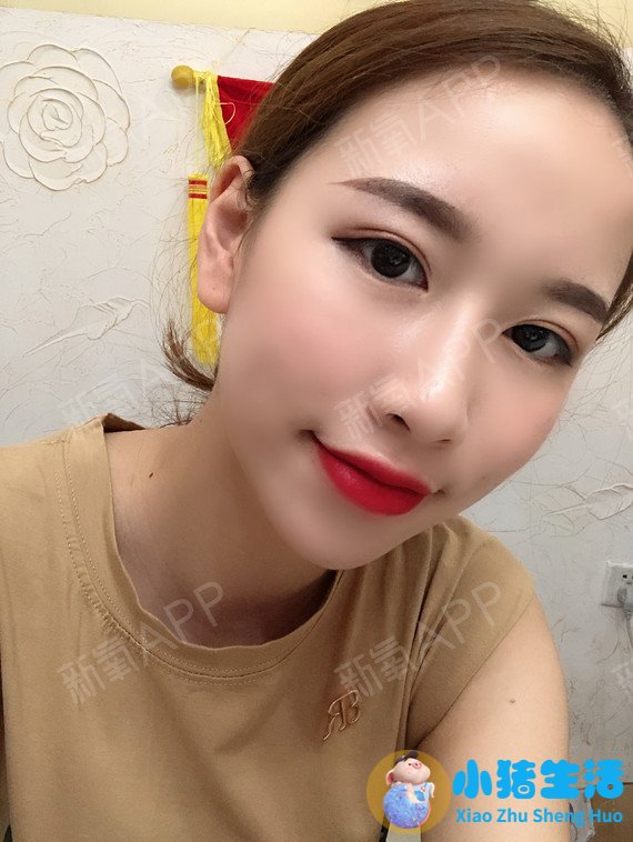 乔爱军整形案例