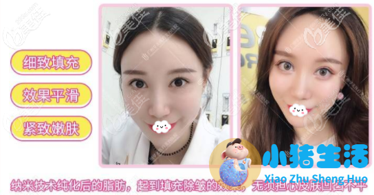 乔爱军整形案例