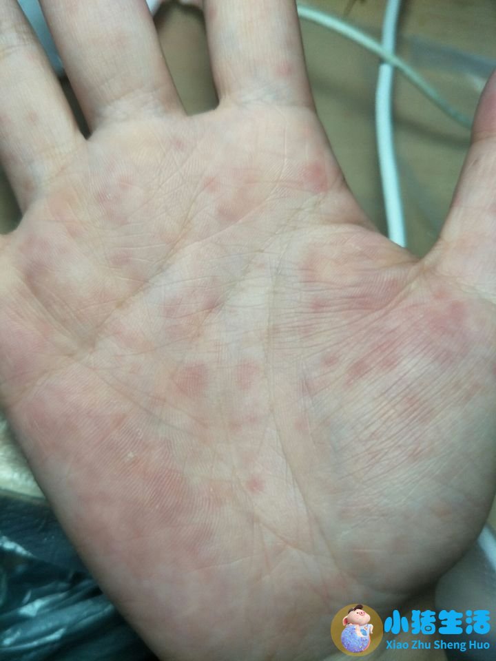 吃什么食物可以长头发