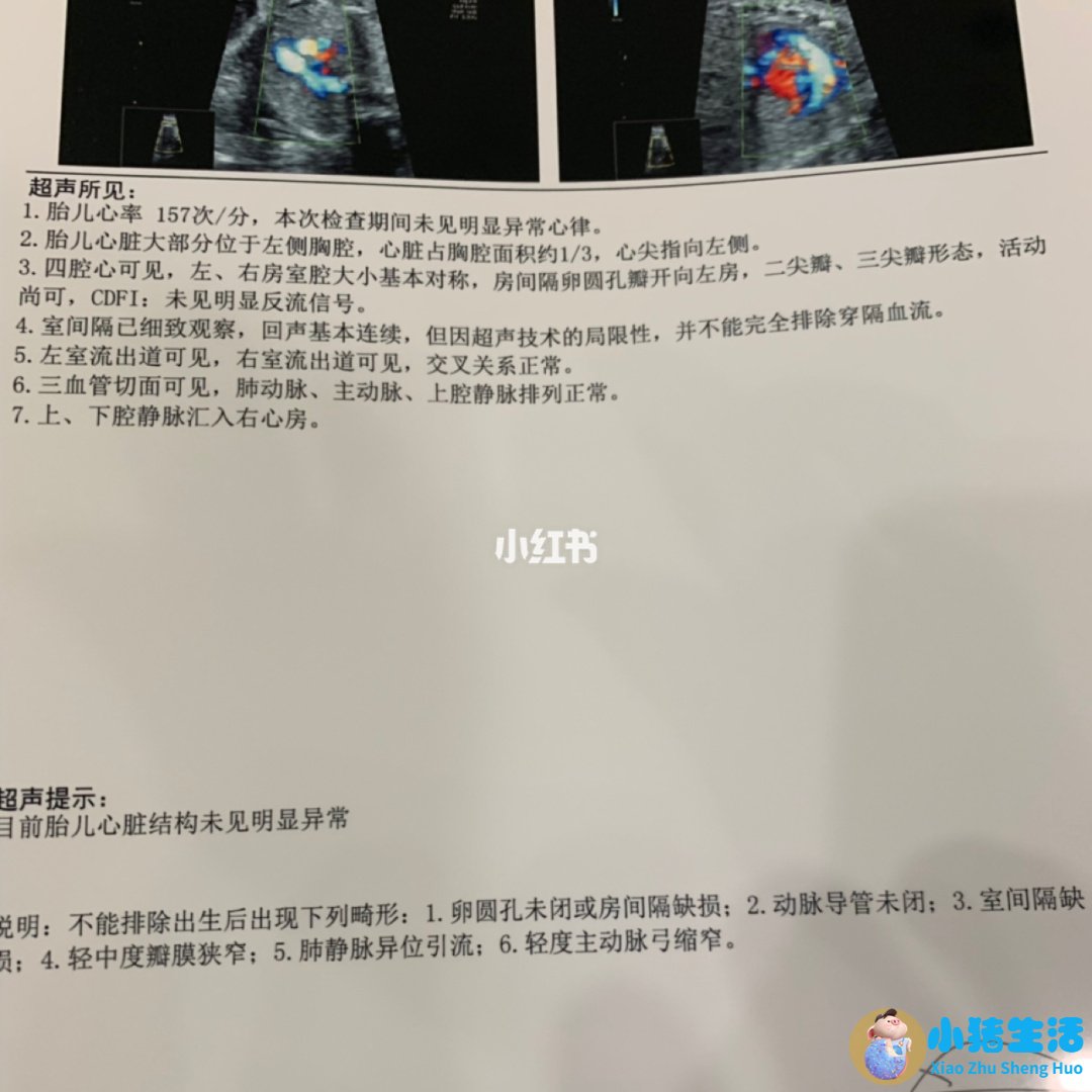 <strong>孕期心脏彩超什么时间做</strong>