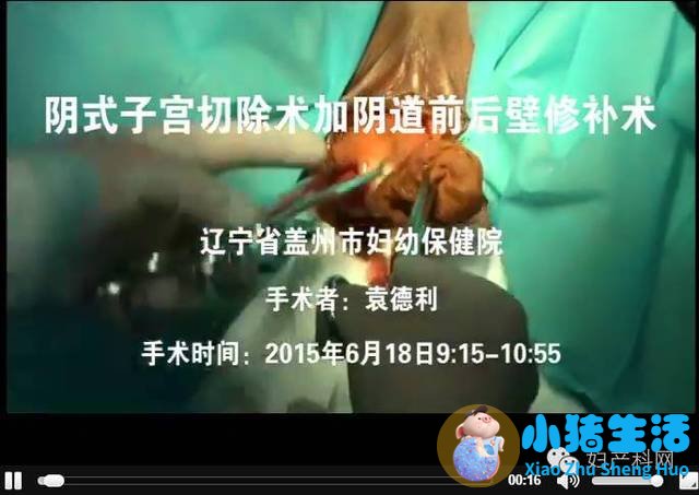 阴道微创手术后的注意事项