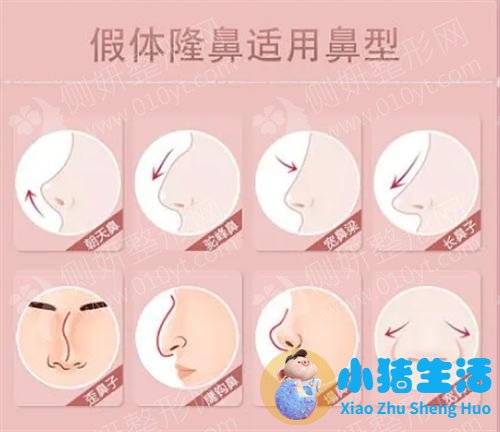 美林苑整形失败案例