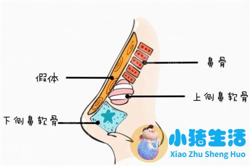 美林苑整形失败案例