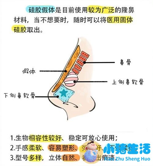 美林苑整形失败案例