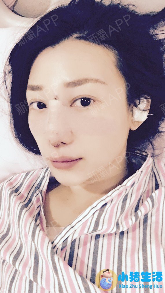 美林苑整形失败案例