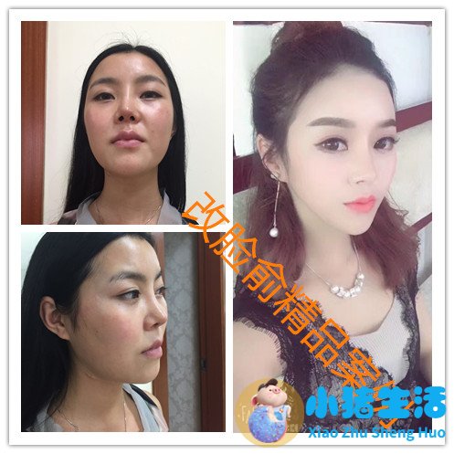 男人魅力痣长在哪里好