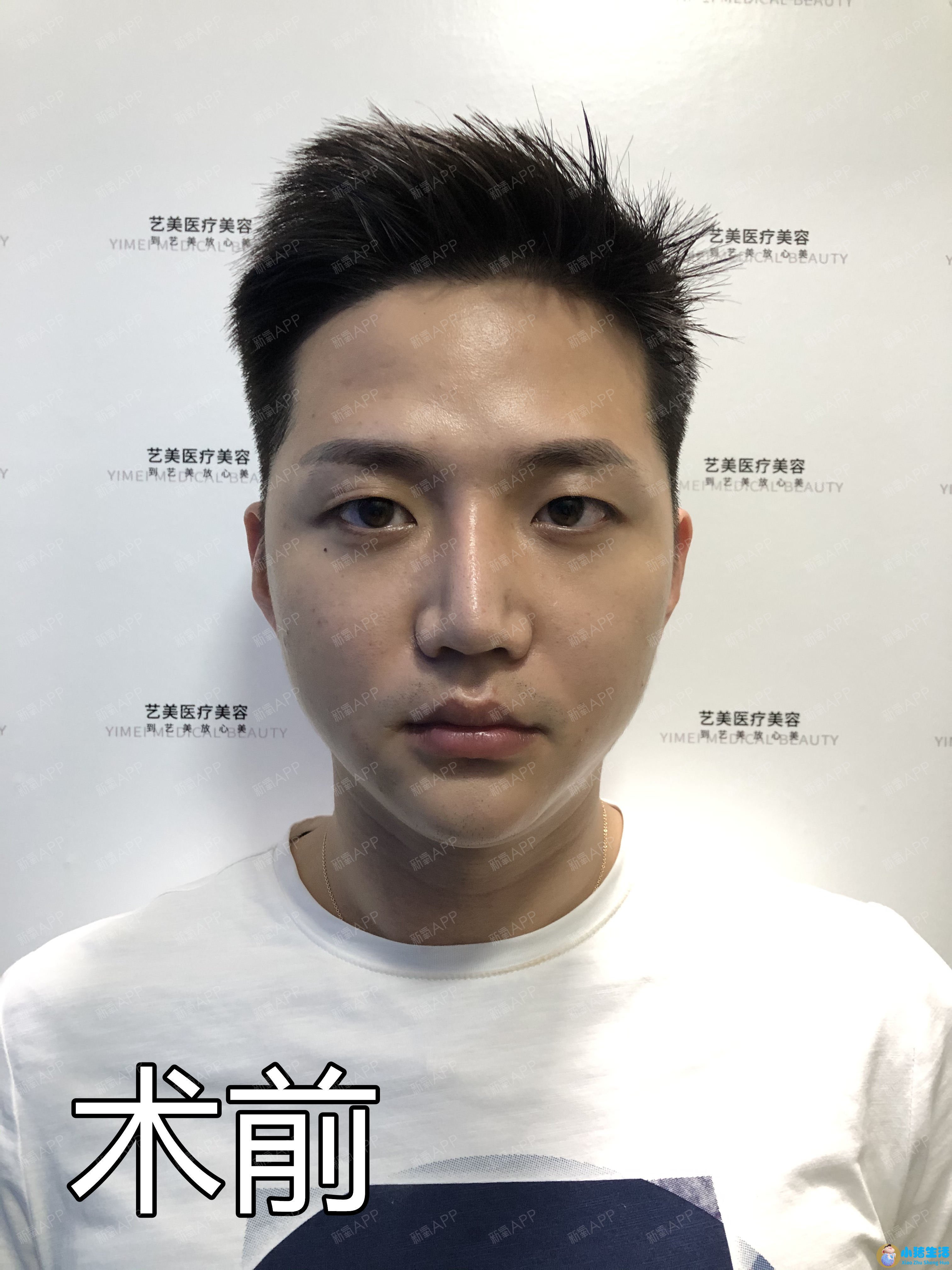 男人魅力痣长在哪里好