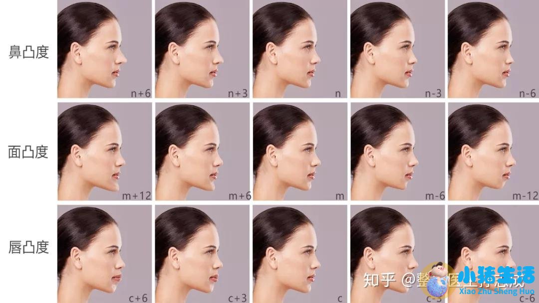 【美人痣长在哪里】桃花痣.docx