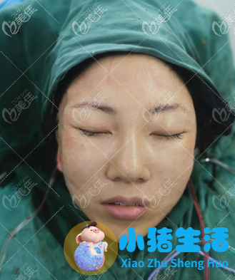 北京除皱美容