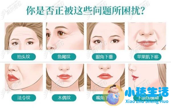 面部拉皮除皱手术适合哪些人做