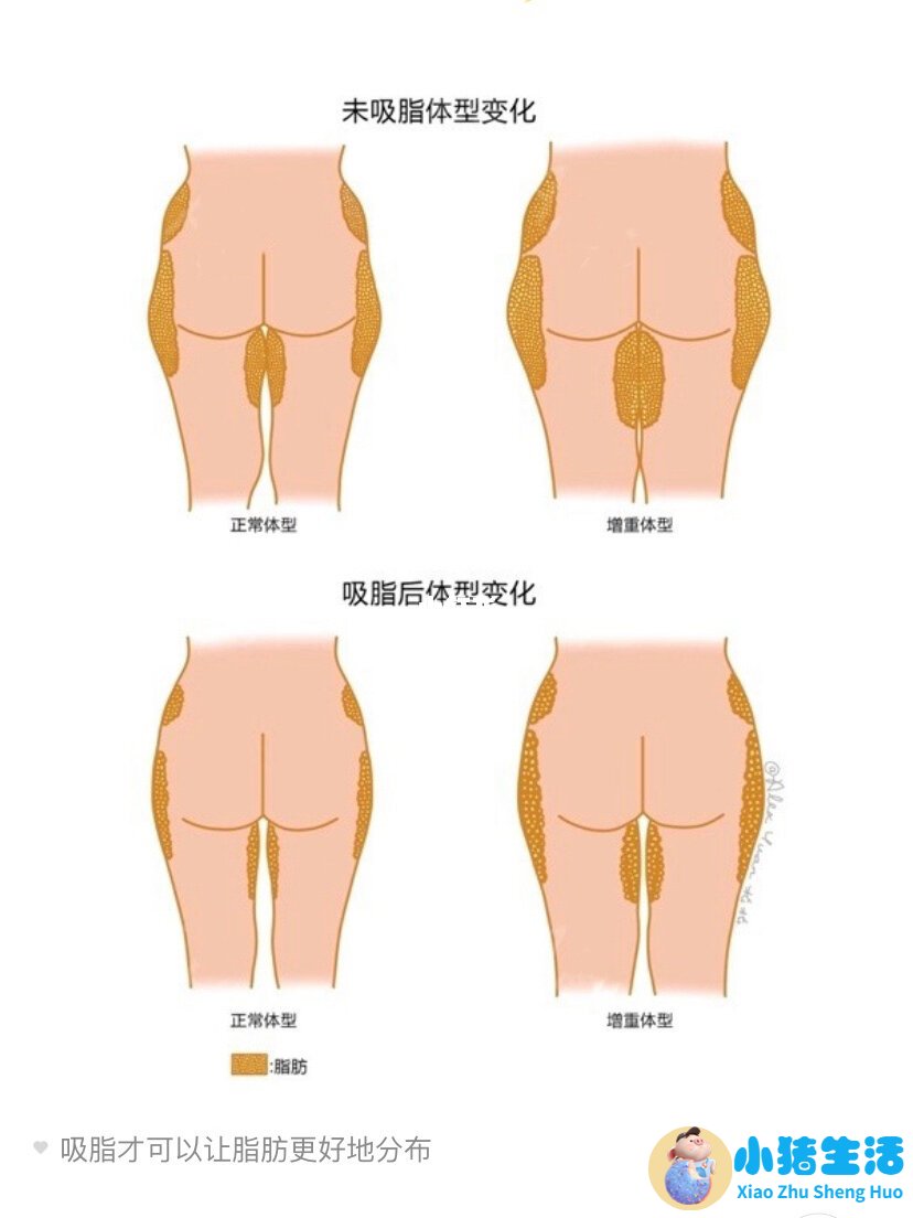 局部减肥知乎