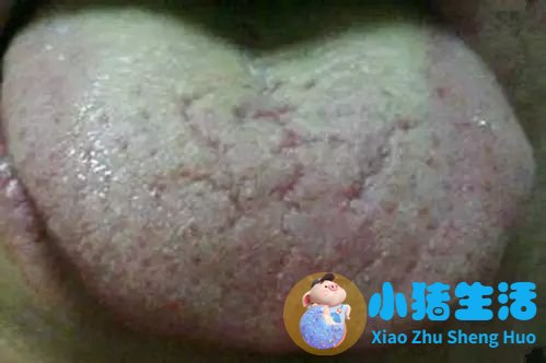怎么科学减肥最有效