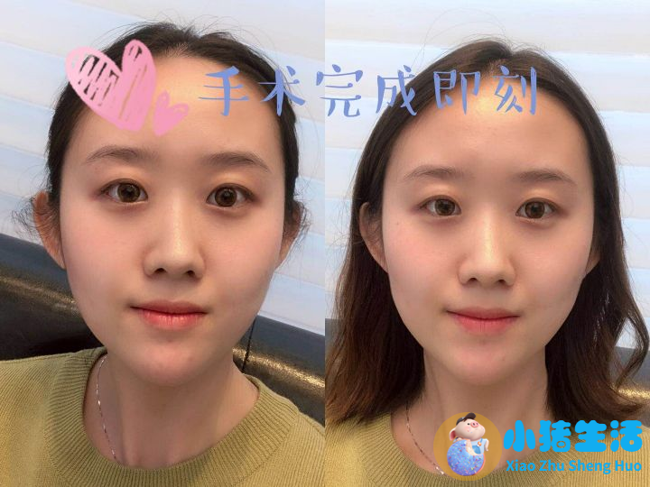 长春医大医院打玻尿酸多少钱一针