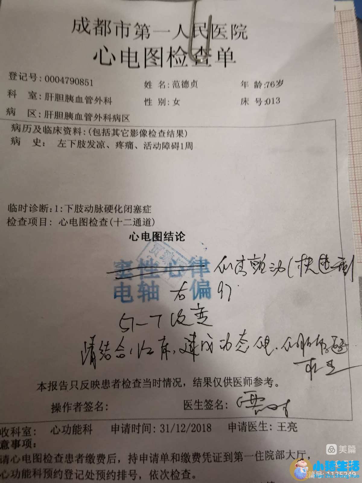 伊美尚整形毁容案例