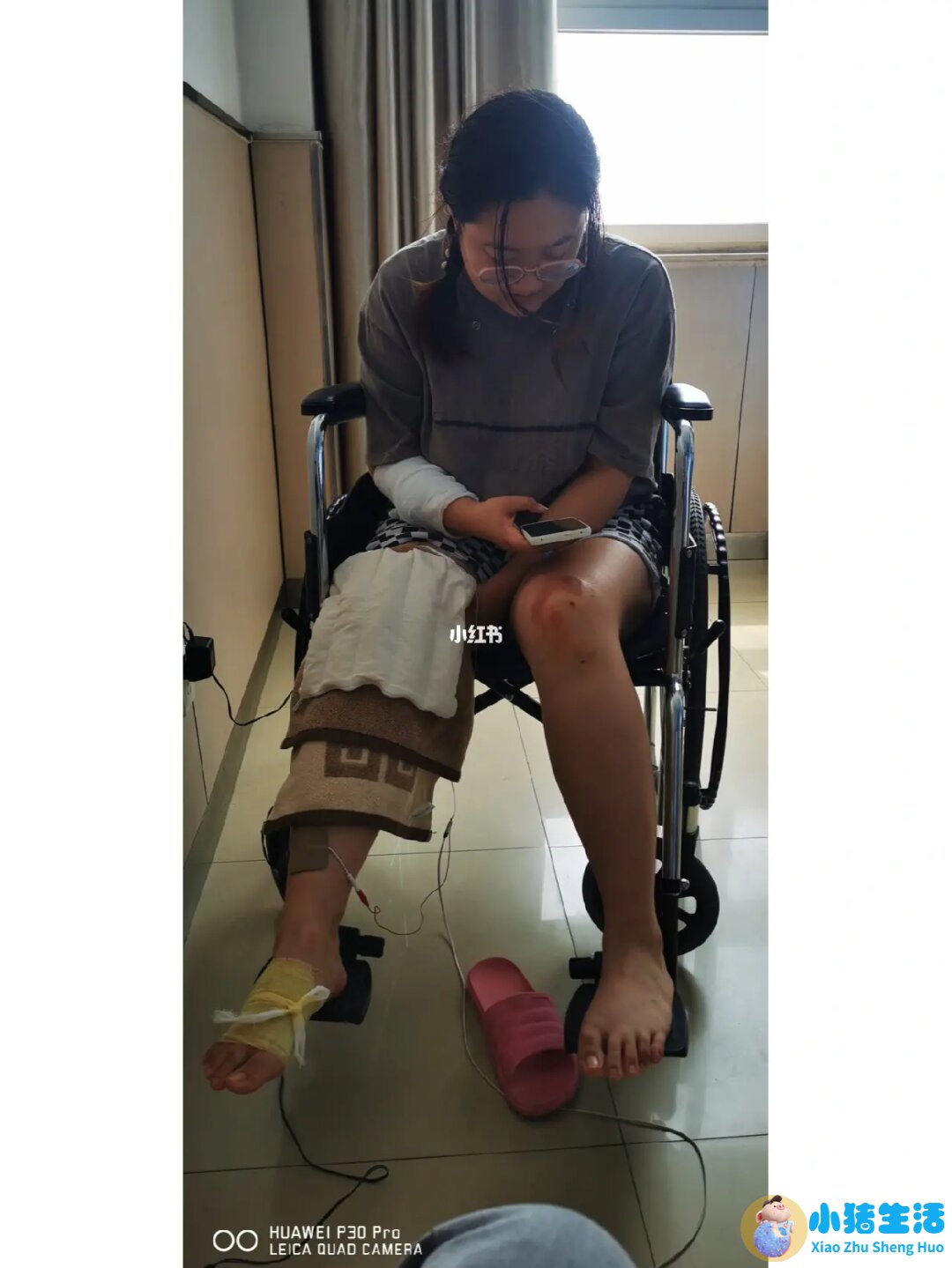 伊美尚整形毁容案例