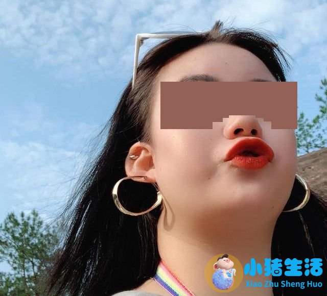 伊美尚整形毁容案例