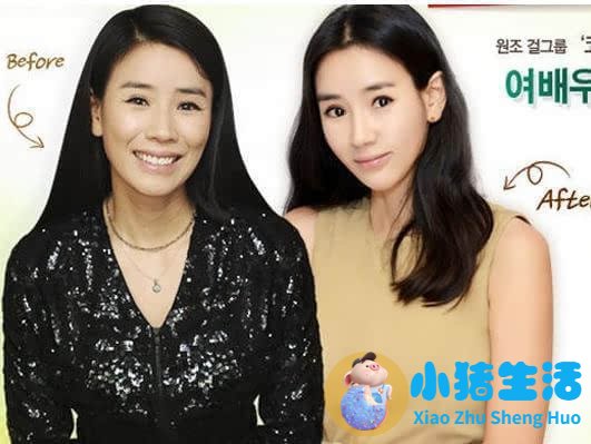 伊美尚整形毁容案例