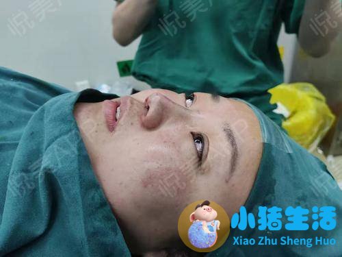 上海柏荟 整形失败案例