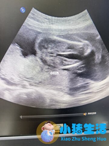 如何简单测怀孕土办法