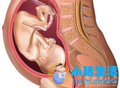 怀孕初期能过安检门吗